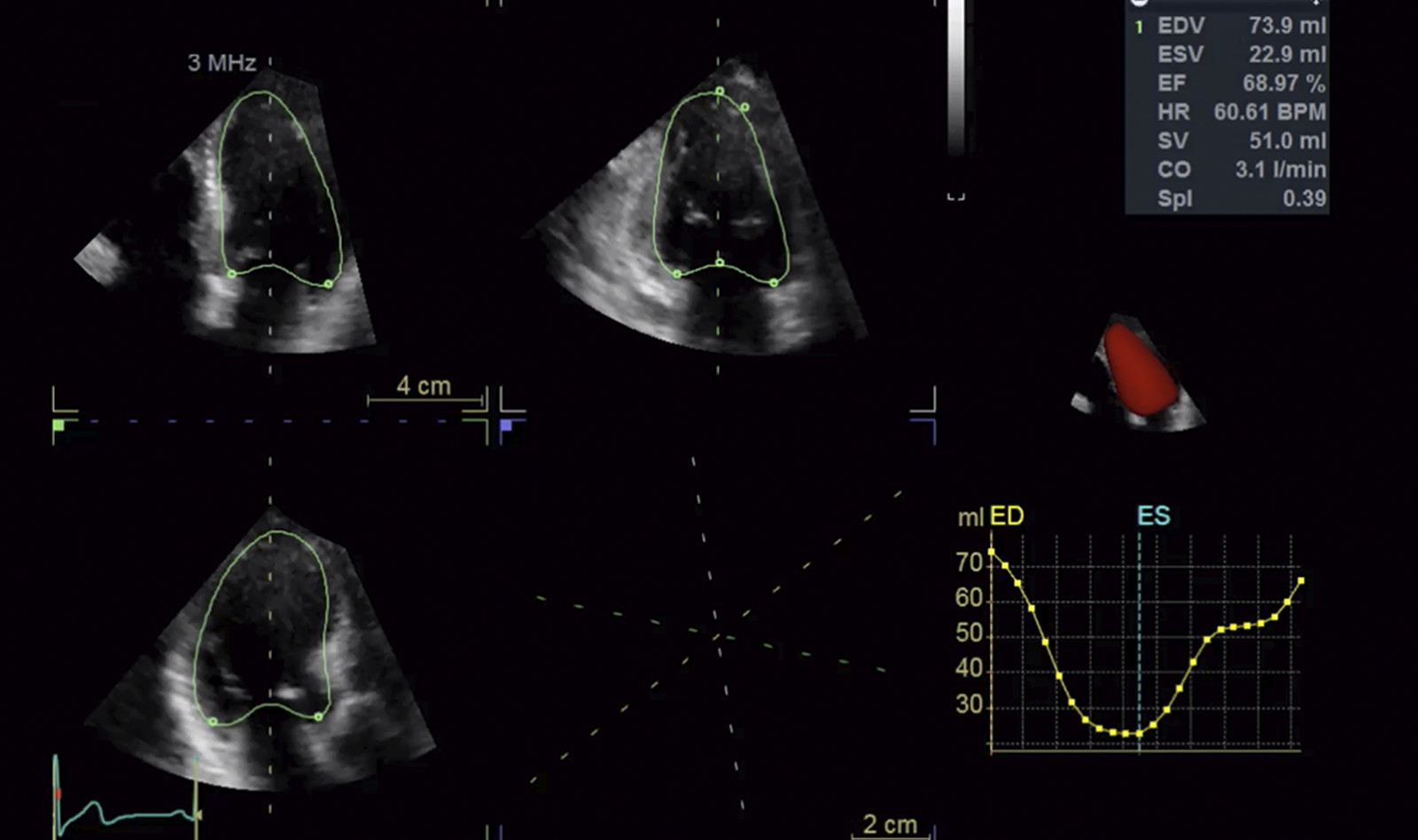 Image of trauma ultrasound trauma treatment heart ultrasound FAST exam cardiac ultrasound    Online PoCUS Training