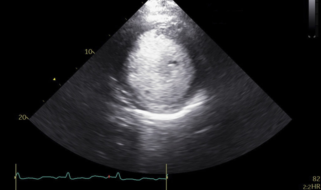 Image of    Online PoCUS Training