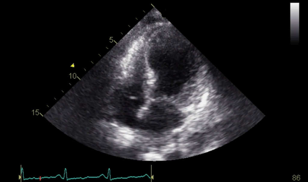 Image of    Online PoCUS Training