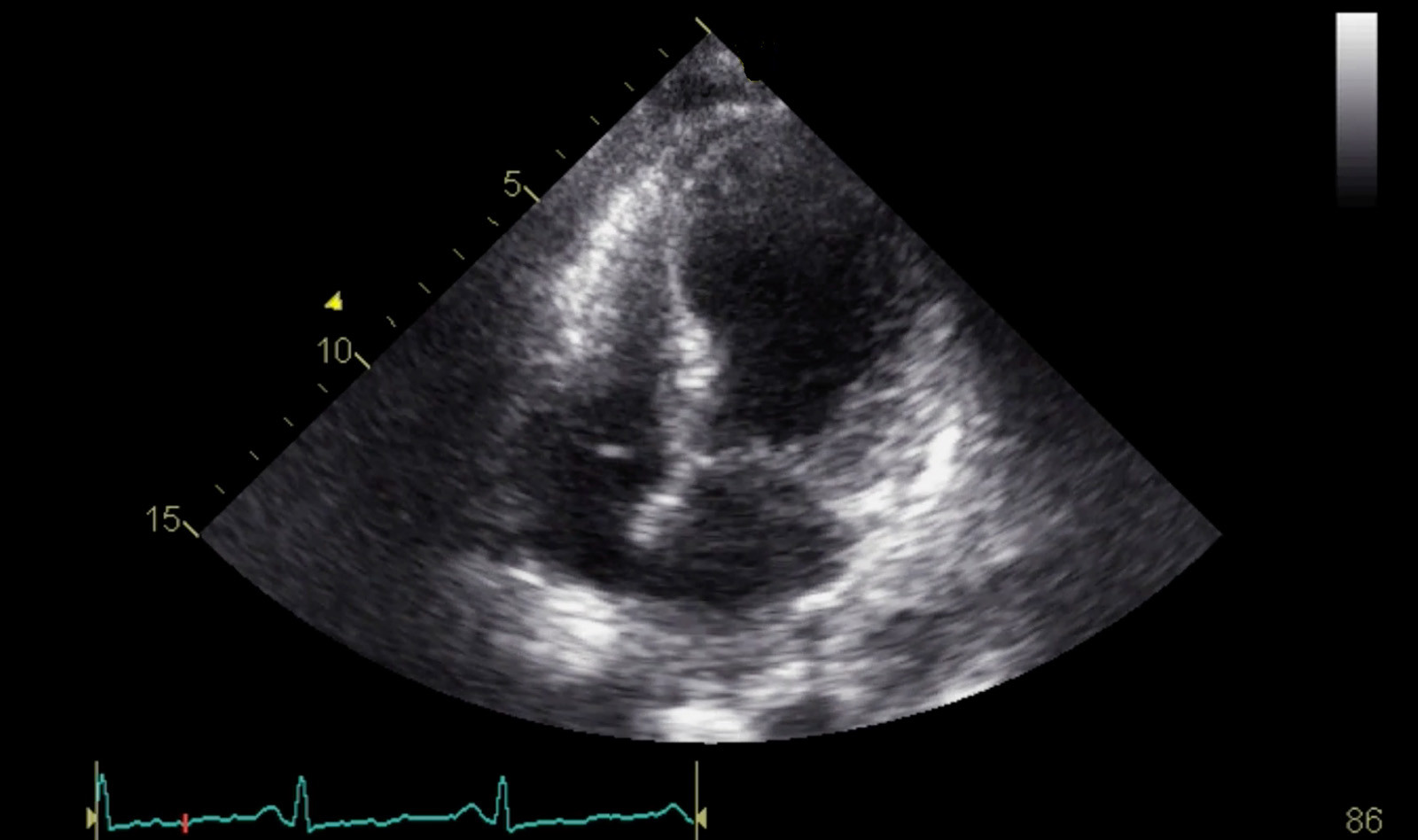 Image of specialist ultrasound training    Online PoCUS Training