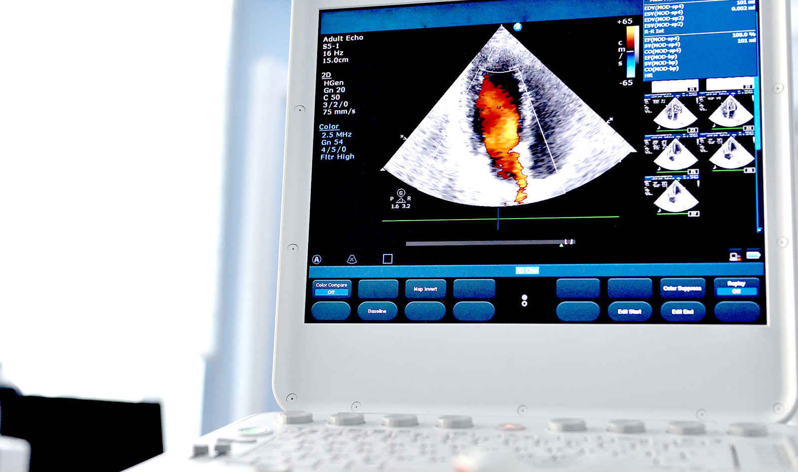 Image of critical care ultrasound cardiac arrest    Online PoCUS Training