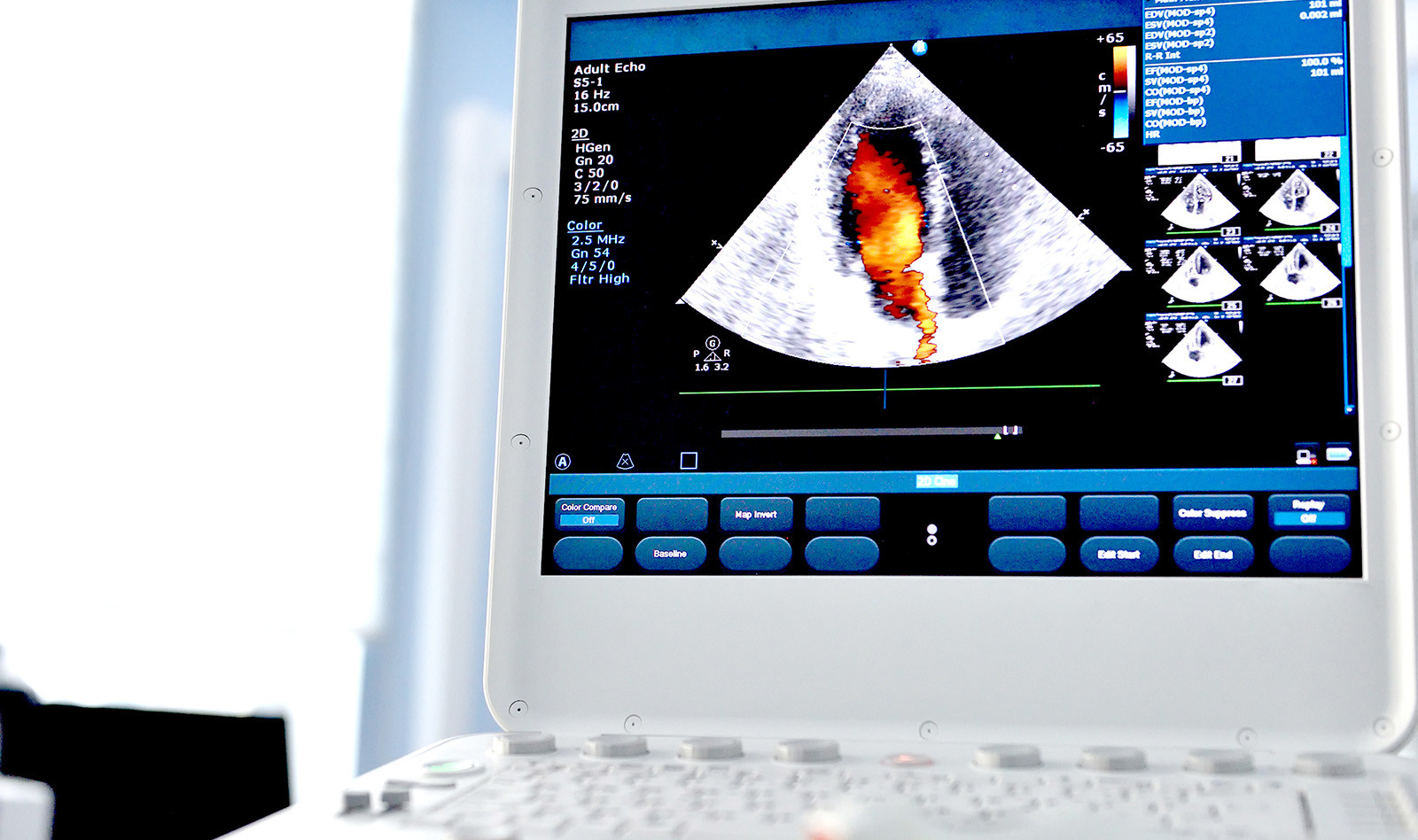 Image of specialist ultrasound training    Online PoCUS Training