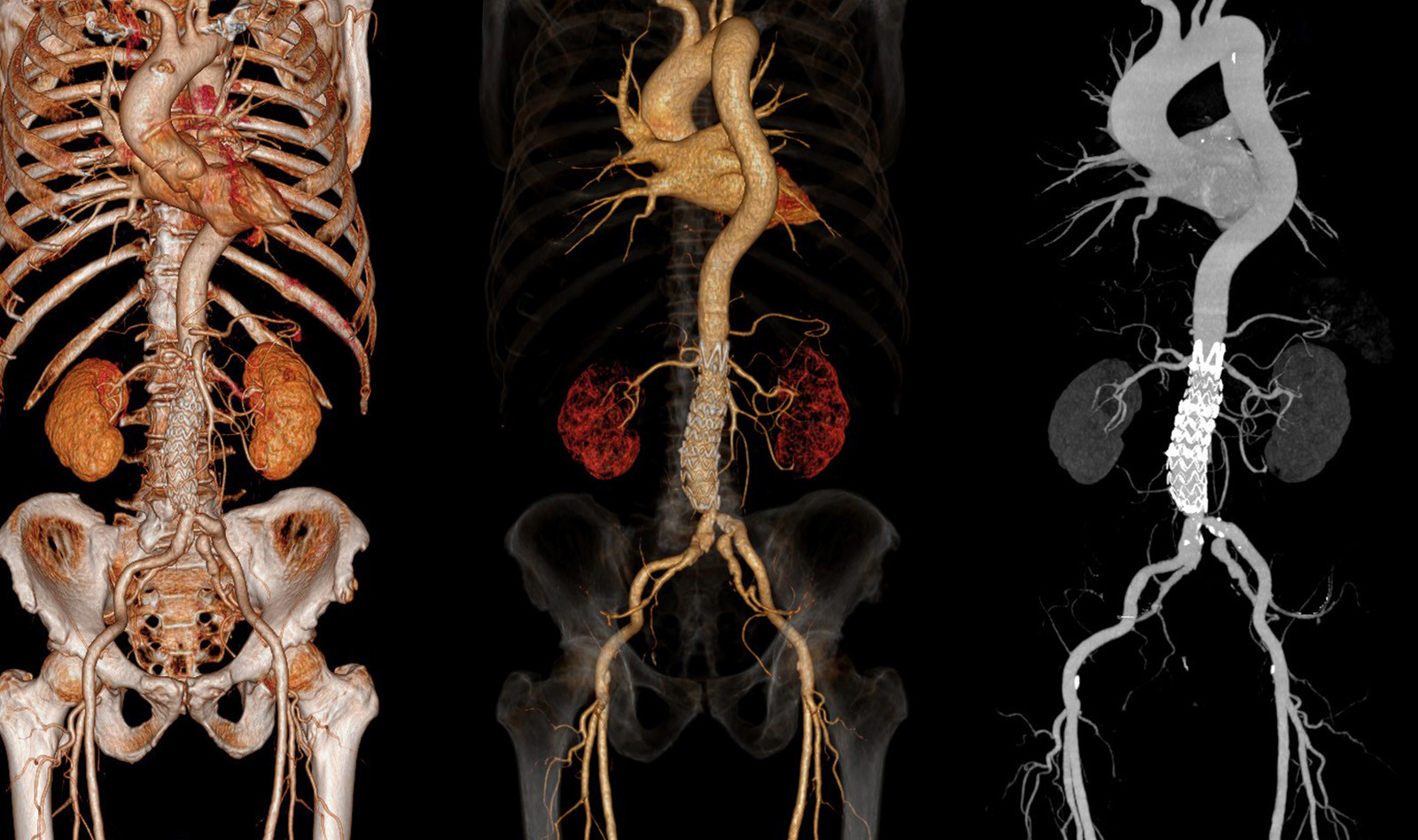 Image of CTA critical care ultrasound CEUS cardiac ultrasonography angiography    Online PoCUS Training