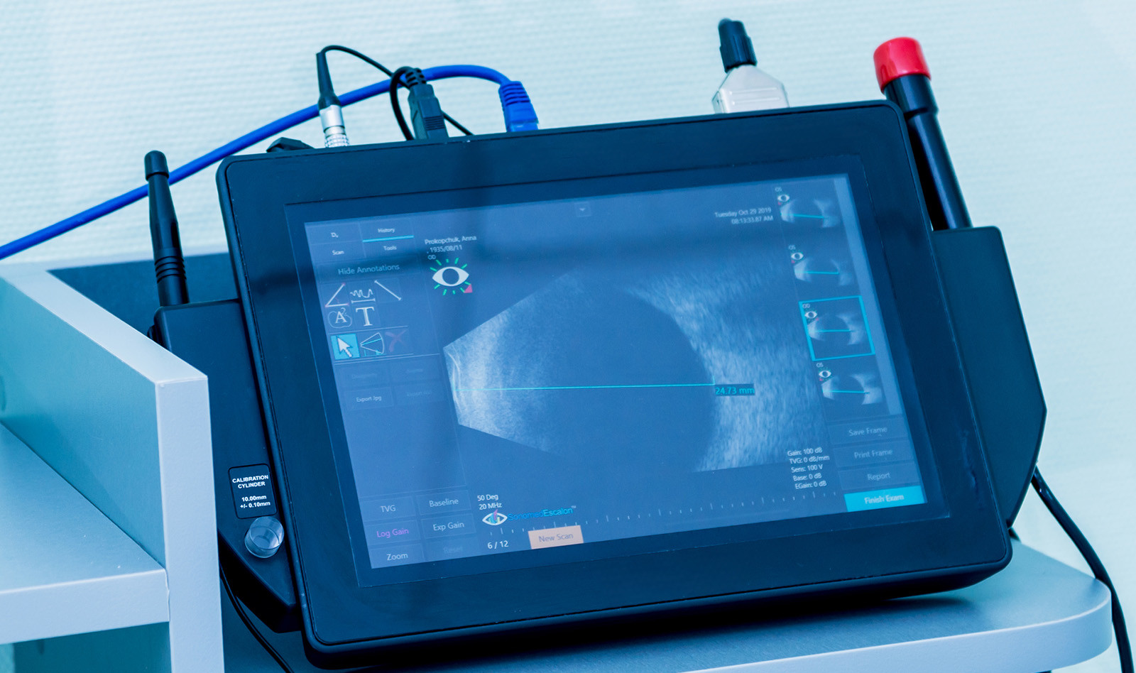 Image of ultrasound of the eye optic nerve ultrasound    Online PoCUS Training