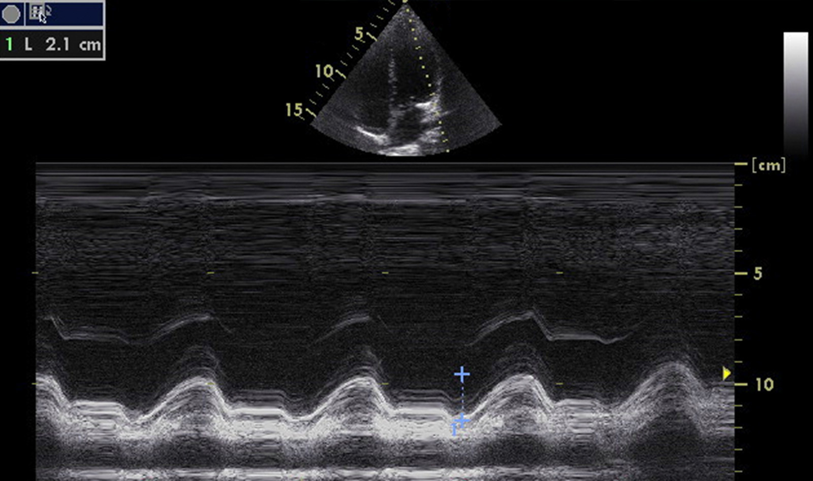 Image of point of care ultrasound point of care ultrasound point of care ultrasound point of care ultrasound point of care ultrasound point of care ultrasound point of care ultrasound point of care ultrasound point of care ultrasound Pediatric POCUS pediatric emergency    Online PoCUS Training