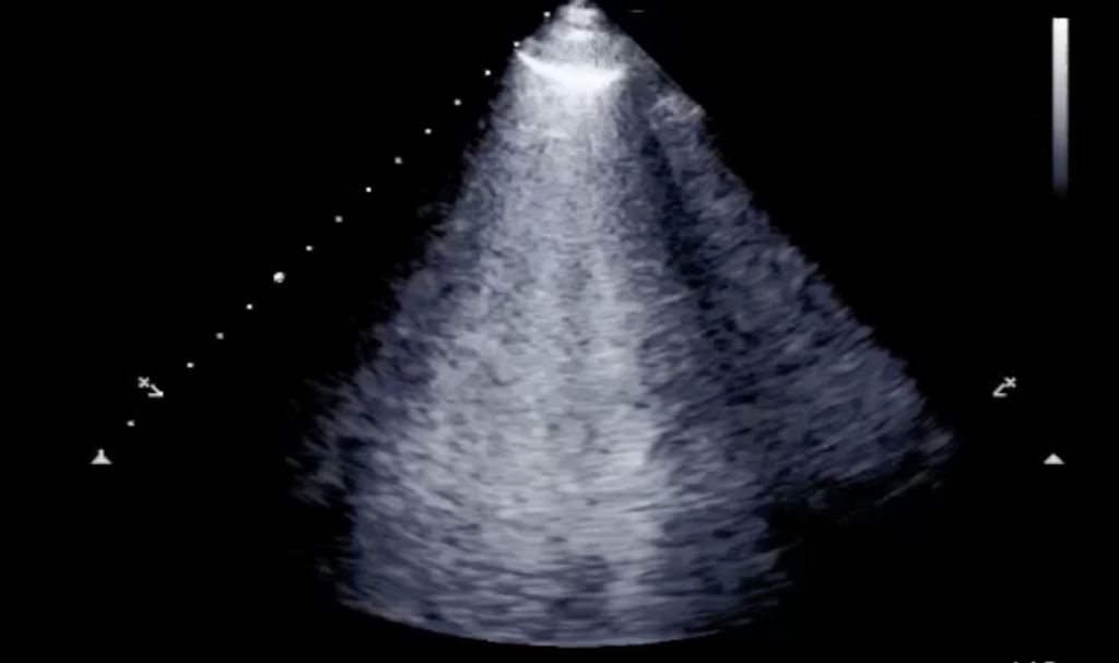 Image of    Online PoCUS Training