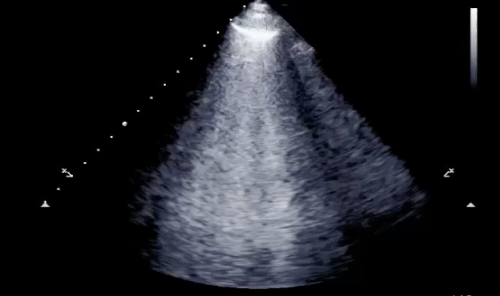 Image of TTE chest x ray    Online PoCUS Training