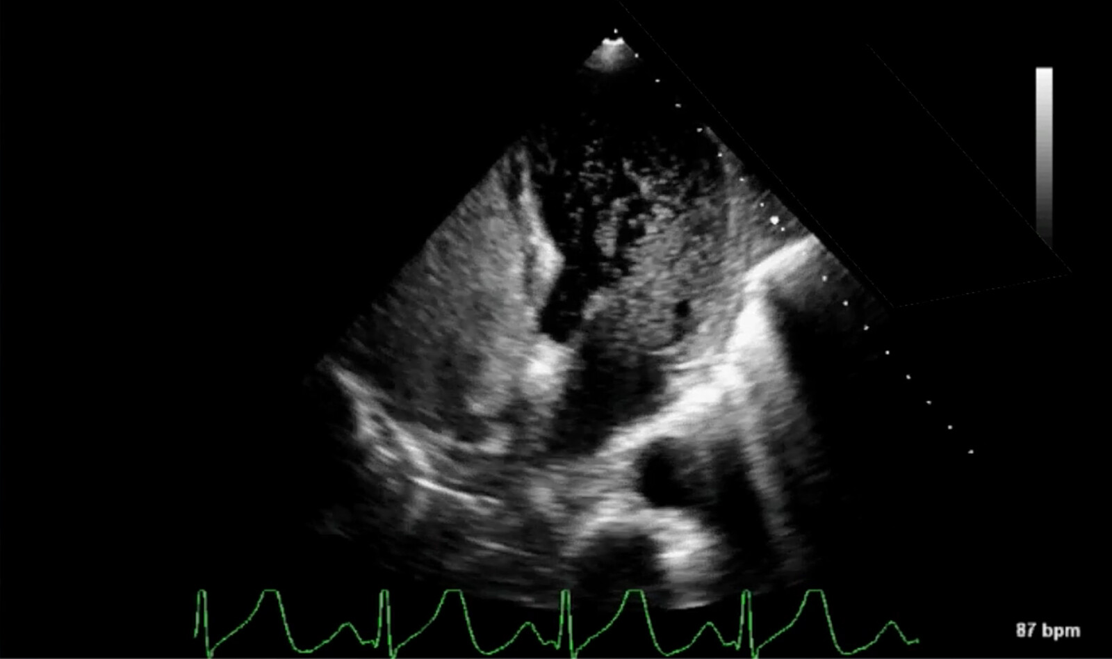 Image of cardiac ultrasound    Online PoCUS Training