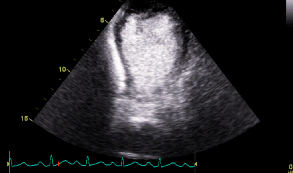 Image of    Online PoCUS Training