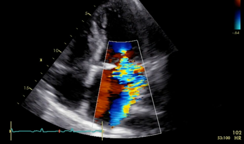 Image of    Online PoCUS Training