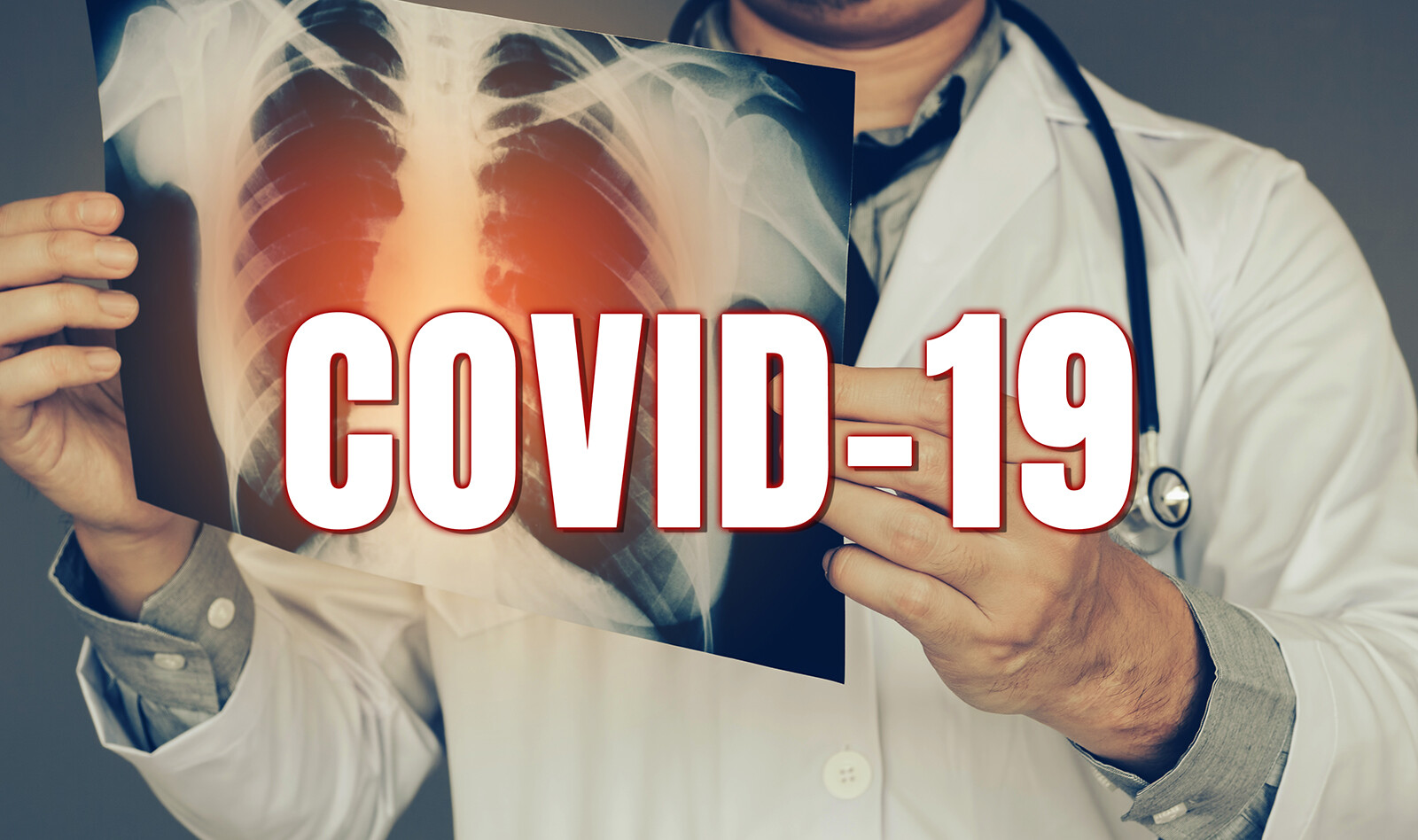 Image of TTE COVID 19 COVID 19 chest x ray    Online PoCUS Training