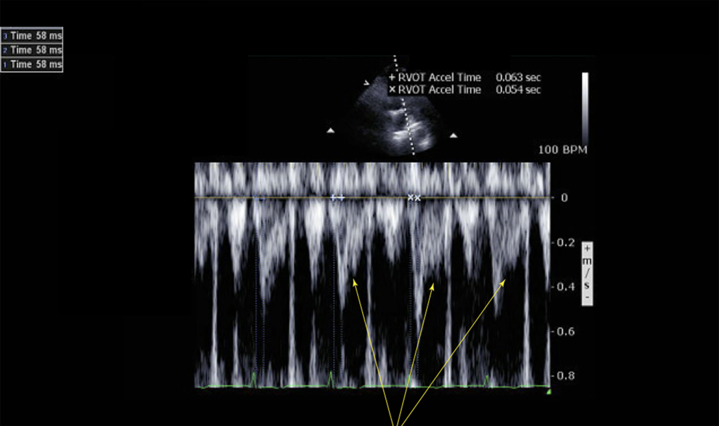 Image of    Online PoCUS Training