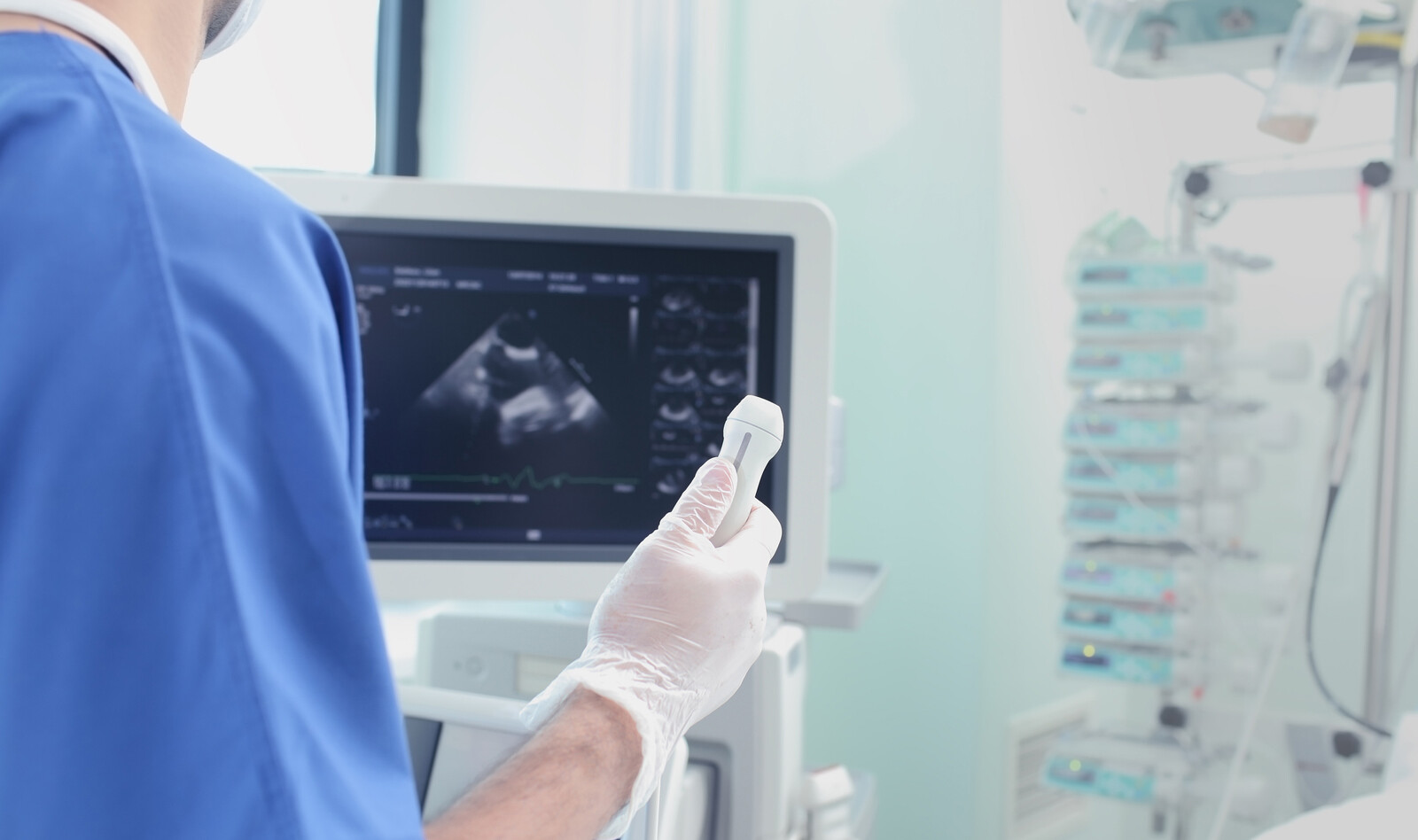 Image of UAPE critical care echocardiography cardiac PoCUS    Online PoCUS Training