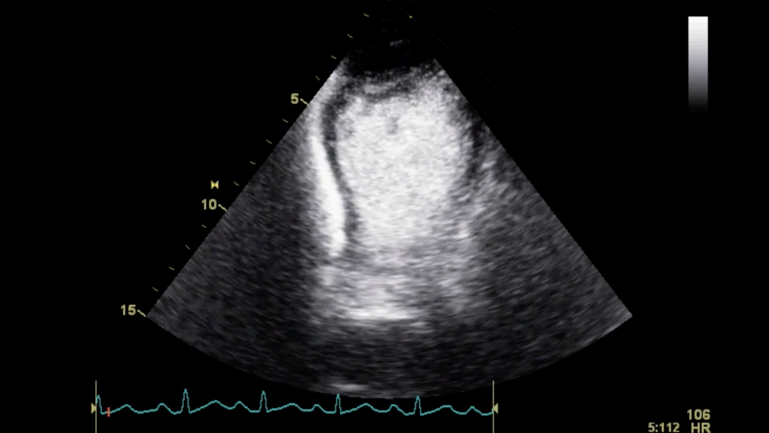 Image of CTA critical care ultrasound CEUS cardiac ultrasonography angiography    Online PoCUS Training