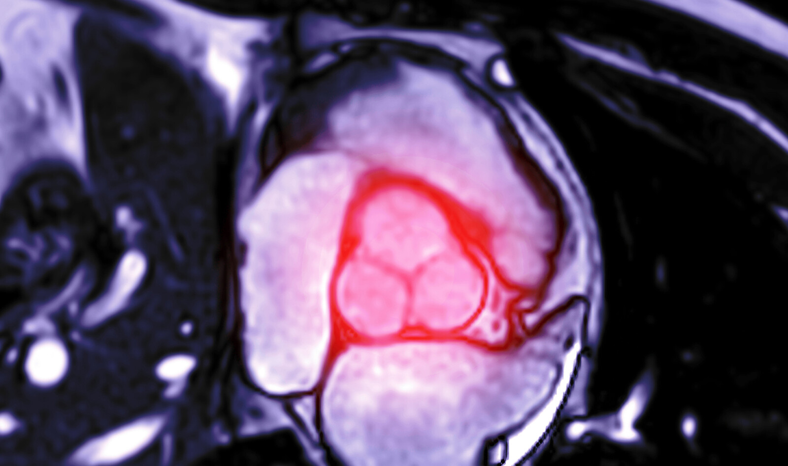 Image of airway ultrasound    Online PoCUS Training