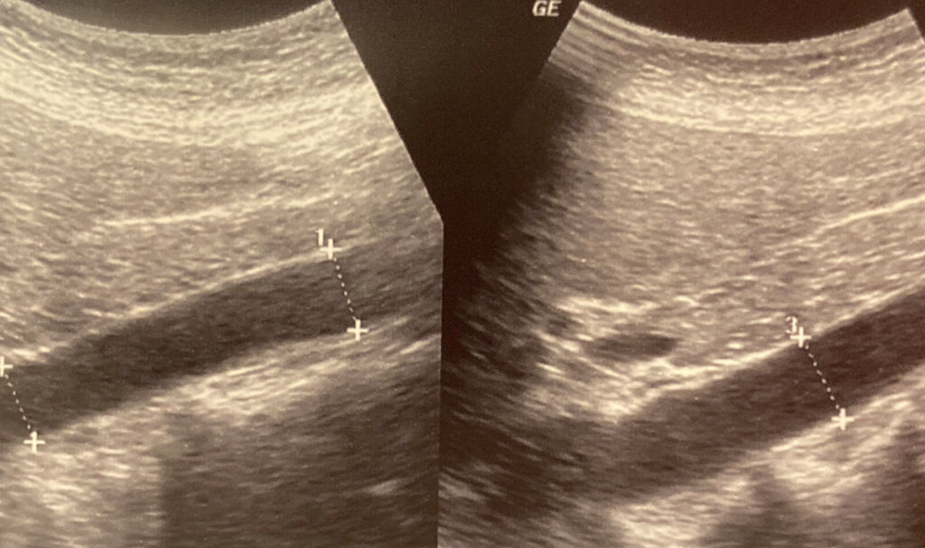 Image of    Online PoCUS Training