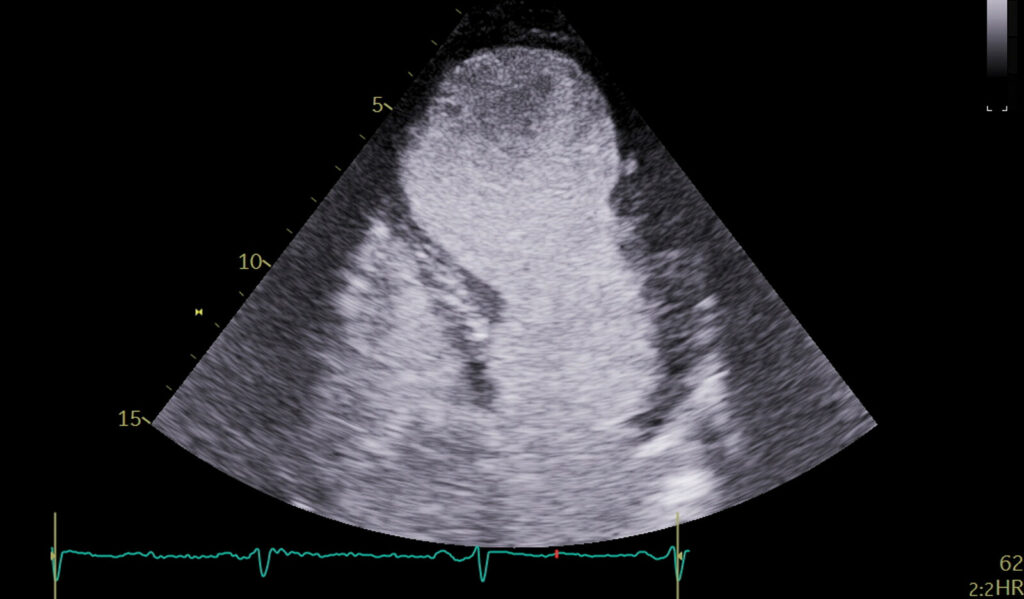 Image of    Online PoCUS Training