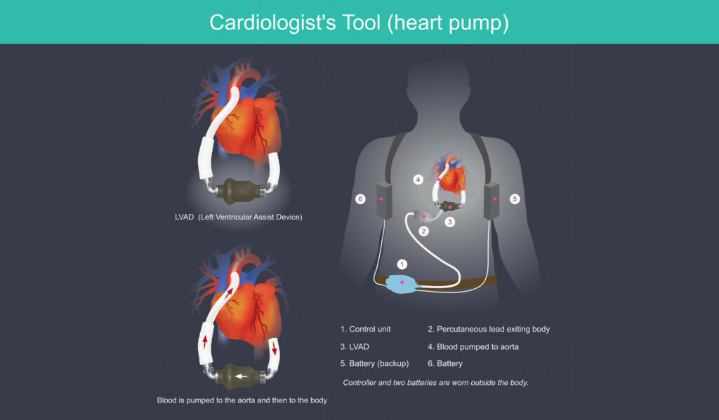 Image of    Online PoCUS Training