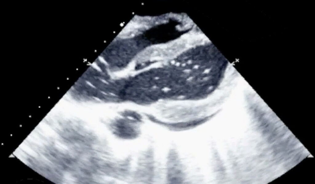 Image of    Online PoCUS Training