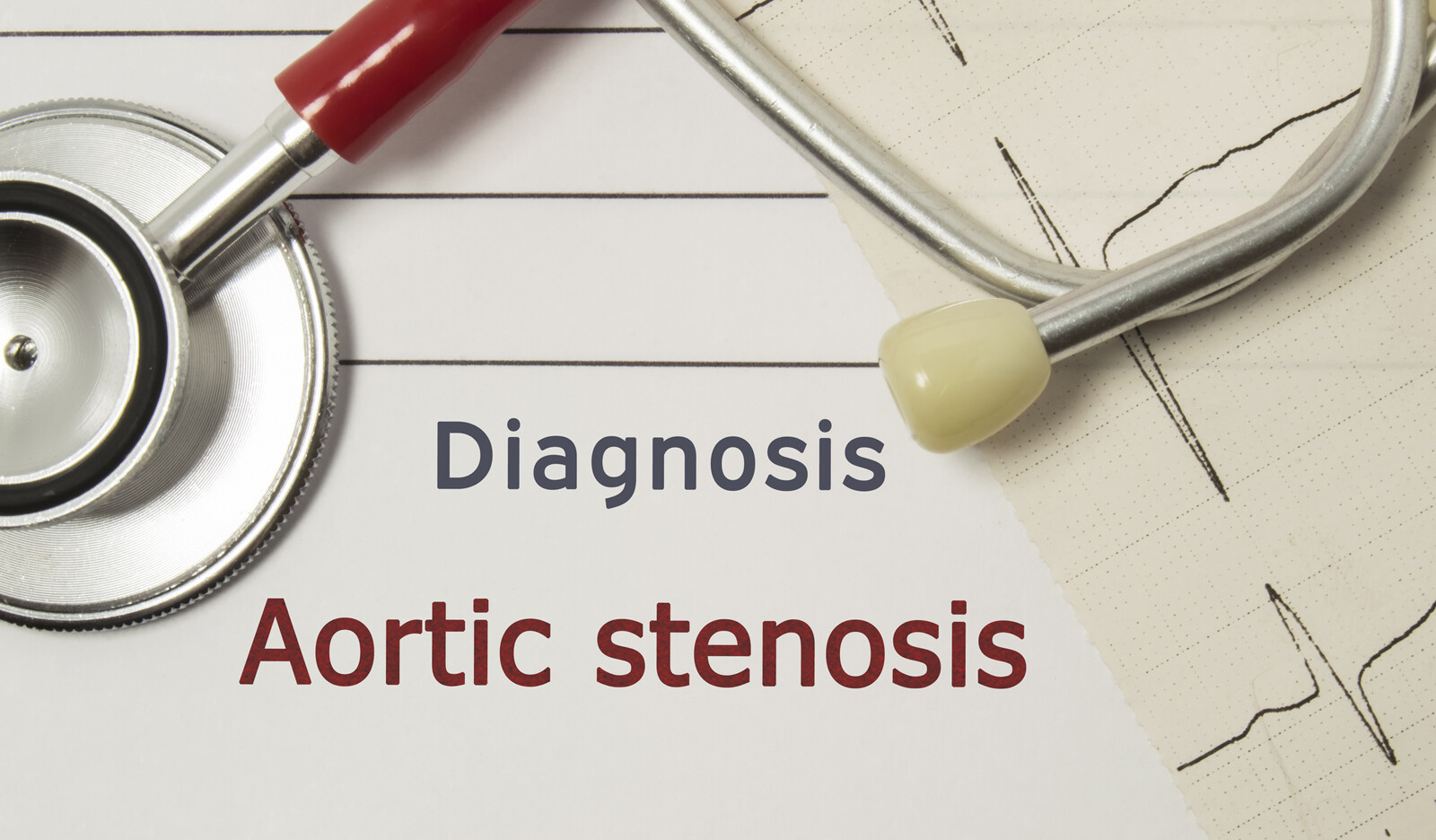 Image of moderate AS left ventricular global longitudal strain cardiac ultrasound AS aortic valve aortic stenosis    Online PoCUS Training