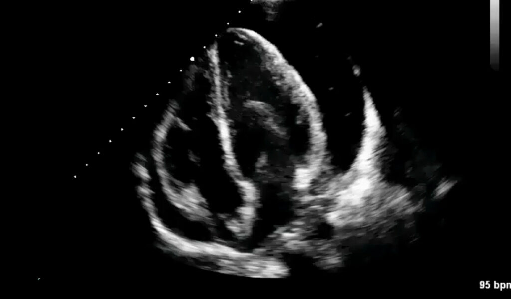 Image of    Online PoCUS Training